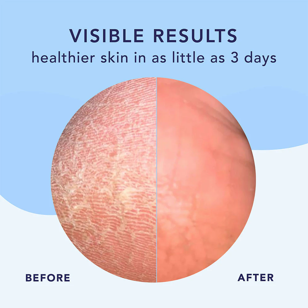 Foot Facial - Image 5